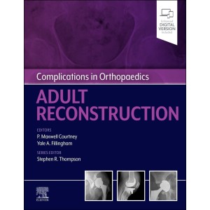 Complications in Orthopaedics: Adult Reconstruction Ορθοπεδική