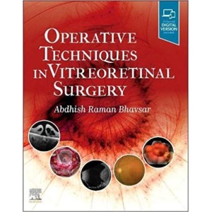 Operative Techniques in Vitreoretinal Surgery Οφθαλμολογία