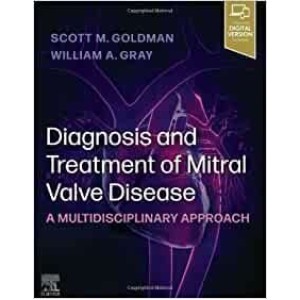 Diagnosis and Treatment of Mitral Valve Disease A Multidisciplinary Approach Καρδιολογία