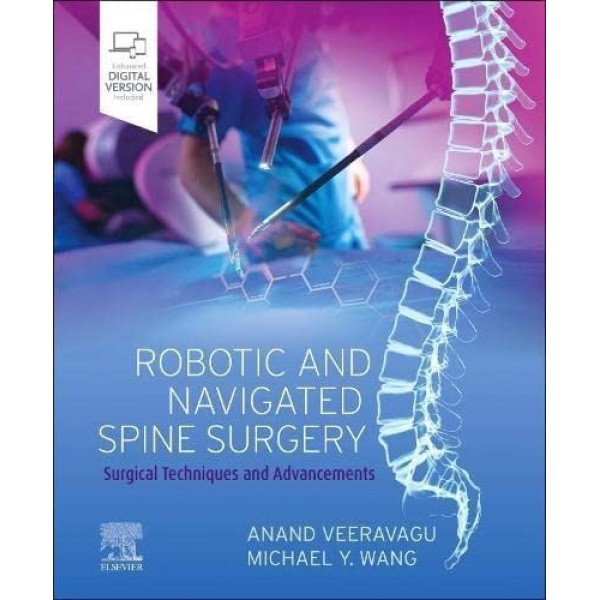 Robotic and Navigated Spine Surgery, 1st Edition Surgical Techniques and Advancements Νευροχειρουργική