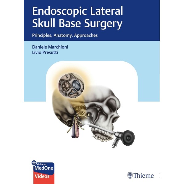 Endoscopic Lateral Skull Base Surgery Principles, Anatomy, Approaches Ωτορινολαρυγκολογία