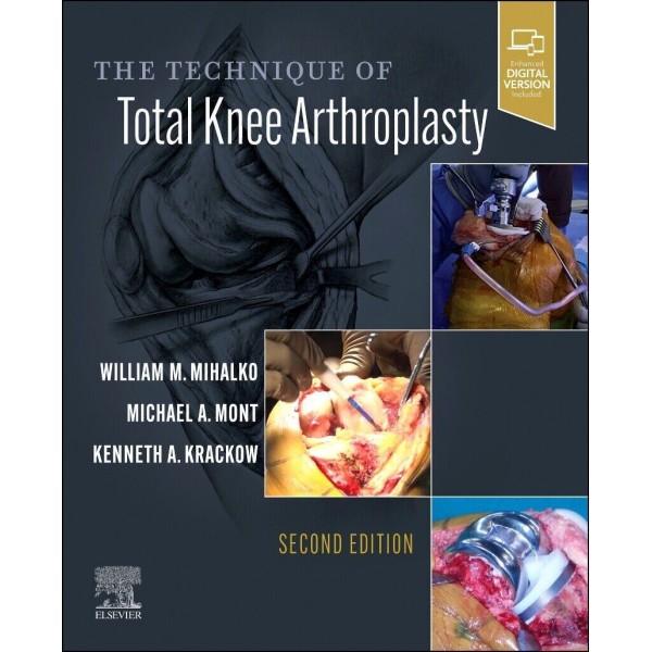 The Technique of Total Knee Arthroplasty, 2nd Edition Ορθοπεδική