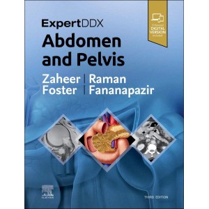 ExpertDDx: Abdomen and Pelvis, 3rd Edition Ακτινολογία