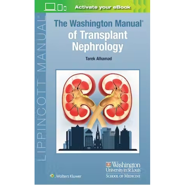 The Washington Manual of Transplant Nephrology, First edition Νεφρολογία